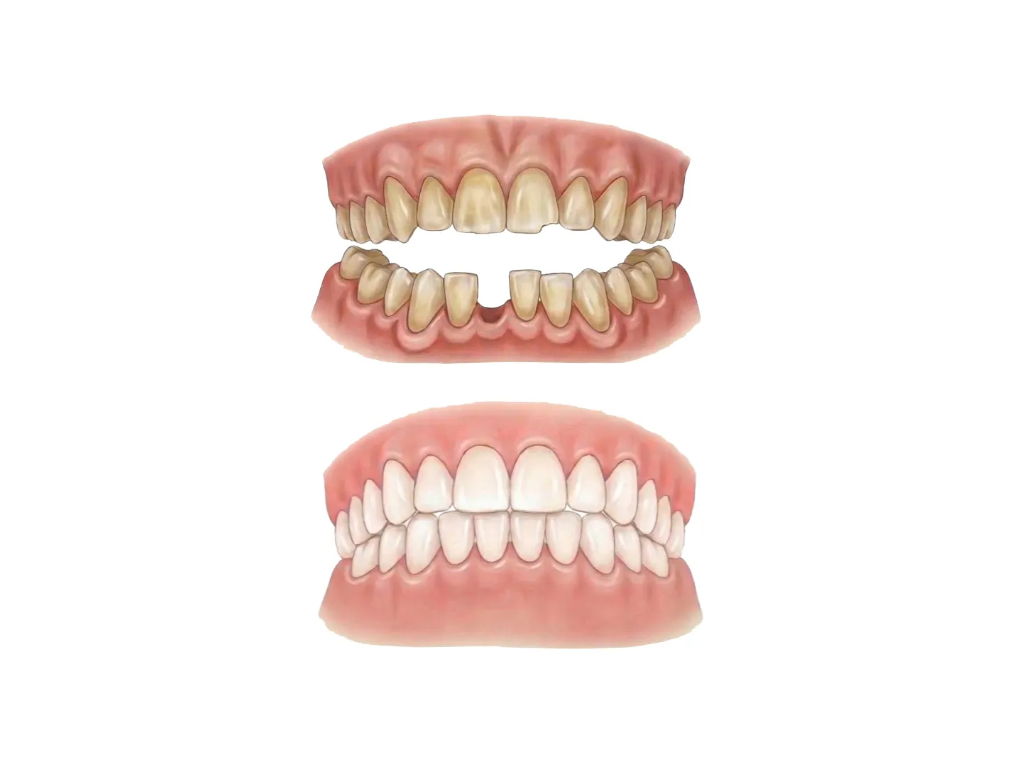 Smile design dental treatment