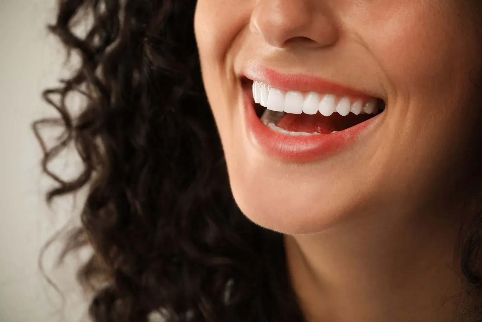 Ilustración: sonrisa y planificación estética dental (diseño de sonrisa)